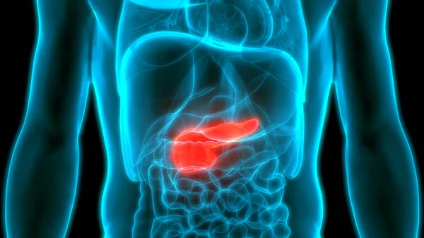 Pancreatic Cancer: What causes pancreatic cancer?