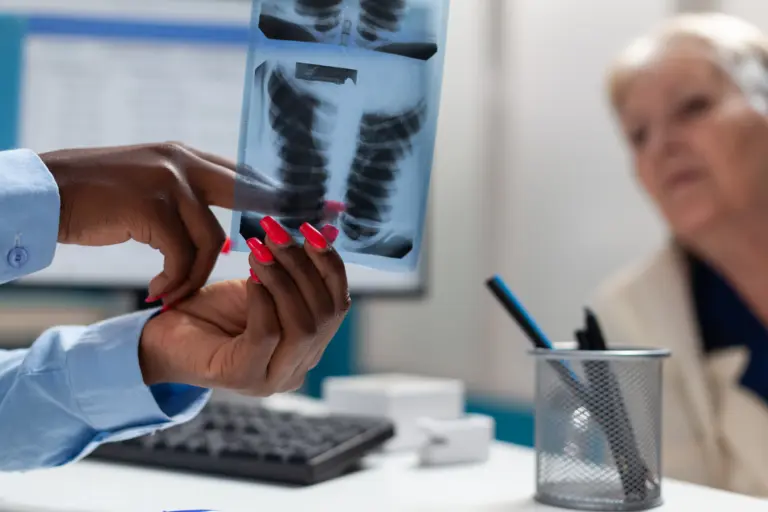 7 Early Signs That Lung Cancer Treatment Is Taking a Toll