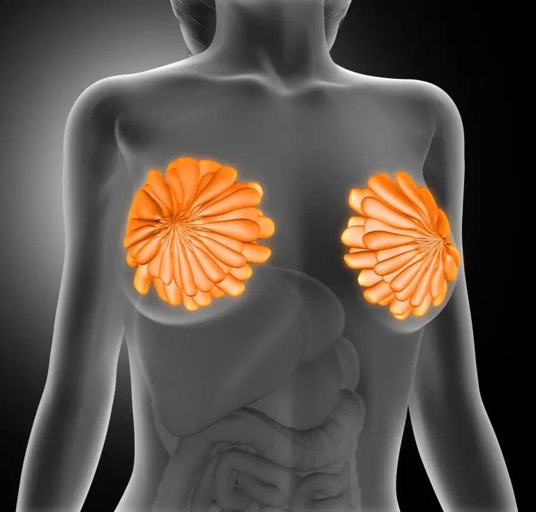 Paget’s Disease of the Breast – Guide